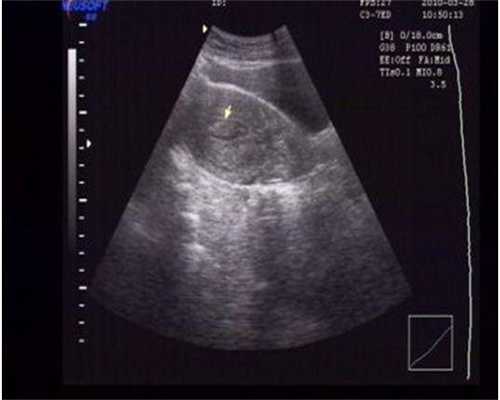 宜昌试管婴儿：仁和医院与中心医院，哪家更好？如何选择？