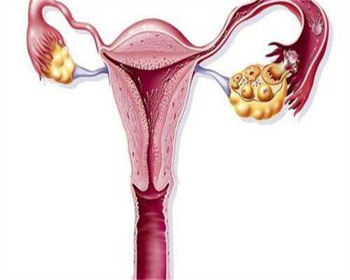 武汉试管婴儿费用解析：了解您的助孕之旅