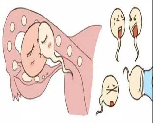 武汉前往格鲁吉亚试管助孕的费用明细与规划