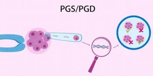 乌海代生包男孩:助您了解乌海地区供卵试管婴儿医院及价格