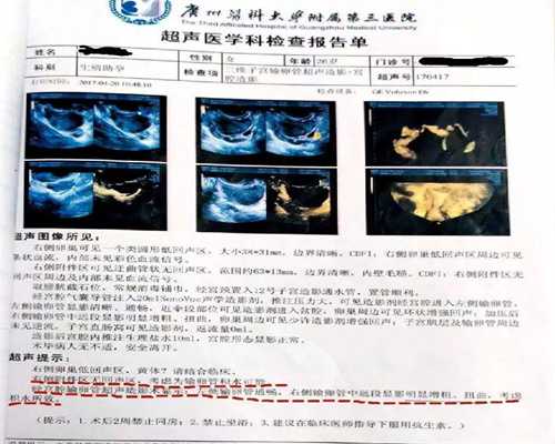 试管婴儿移植手术费用解析，代怀宝宝移植费用多少
