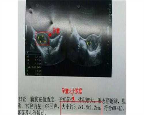 武汉代生女儿生殖医院地址武汉春晖助孕